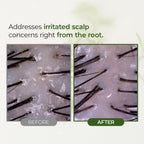 Tea Tree Scalp Water Scaler | Scalp Exfoliator for Itchy Dry Flaky Scalp, Buildup Remover, Treatment for Excess Sebum Oily Greasy Hair | Korean Hair Care Products, Travel Size, 1.69 fl oz