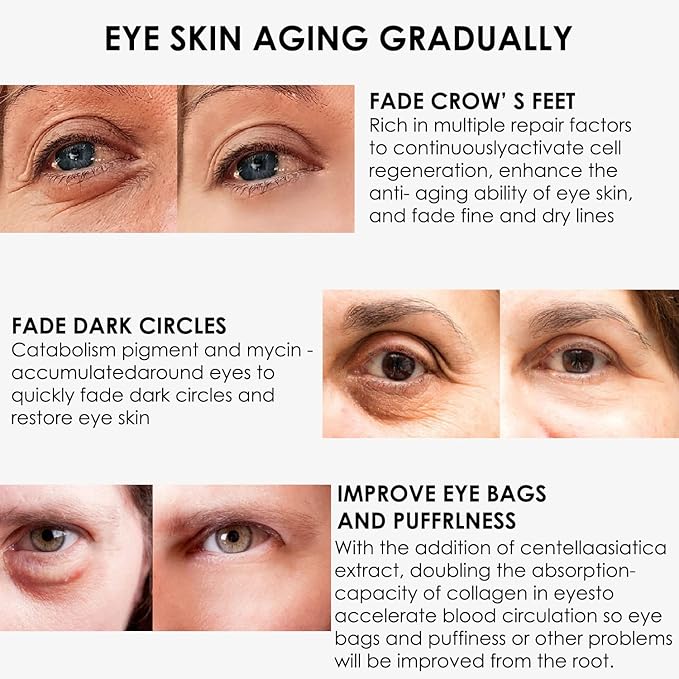 Eye Cream, STCORPS7 Vibrant Glamour Silk Protein Anti-Wrinkle And Firming Eye Cream For Wrinkles, Fine Lines, Dark Circles, Puffiness & Bags, 20g