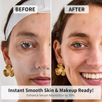 Face Razors for Women, Dermaplane Razor for Women Face, Eyebrow Razor, Facial Razors, Dermaplaning Tool, Reusable Metal Handle with 8 Microblades for Sensitive Skin, Peach Fuzz Remover, Green