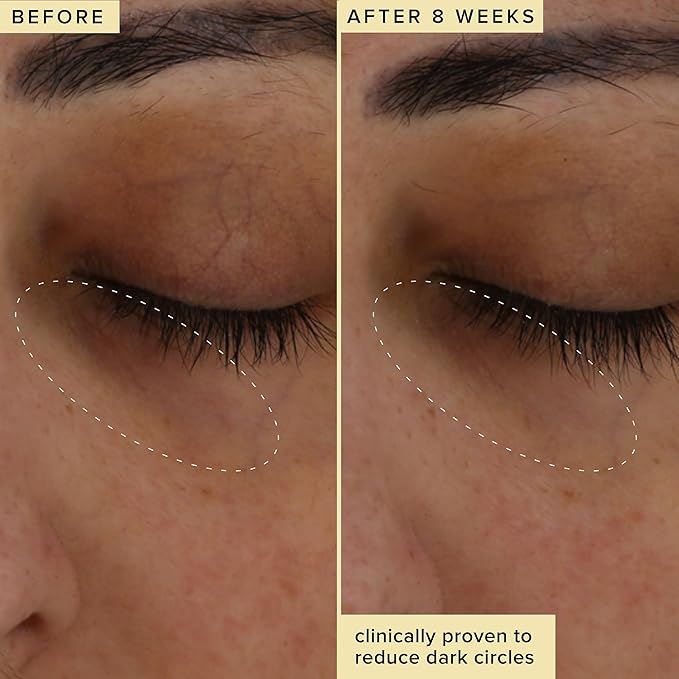 Farmacy Brightening Eye Cream - Wake Up Honey Under Eye Cream for Dark Circles + Puffiness - Caffeine Eye Cream Enriched with Vitamin C + Cranberry Peptide to Smooth Wrinkles Over Time (15ml)