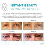 Instantly Ageless Facelift in A Box - Instant Eye Bag Remover Puffiness -1 Box of 25 Vials - Instant Under Eye Bags Remover - Wrinkle Tightener - Instant Wrinkle Remover for Face Instant Lift