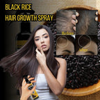 Black Rice Water Hair Growth Spray with Biotin - Rice water HAir spray for Thinning Hair and Hair Loss, All Hair Types, Men and Women