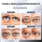 Advanced Snail Hydrogel Eye Patch 60 Patches, Gel Serum Mask, Undereye Treament, Fine Lined, Puffy Eyes, Refresh, Hydrate, Paraben free, Phthalates free, Skincare