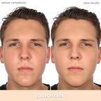 Almay Clear Complexion Acne Foundation Makeup with Salicylic Acid - Lightweight, Medium Coverage, Hypoallergenic, Fragrance-Free, for Sensitive Skin, 099 Porcelain, 1 fl oz.