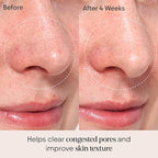 ALPYN Clarifying Facial Oil with Retinol & Pink Algae | Clear Congestion, Smooth Fine Lines, Improve Texture & Glow | 1 Fl Oz / 30 ml