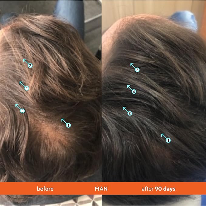 DS Labs Revita Shampoo – High-Performance Hair Density Shampoo, Volumizing & Thickening, Fuller, Healthier-Looking Hair, Sulfate & Silicone Free, For Men & Women, 205mL (Pack of 2)