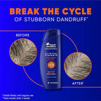 Head & Shoulders Clinical Dandruff Defense + Dry Scalp Rescue Shampoo 13.5 oz Twin Pack