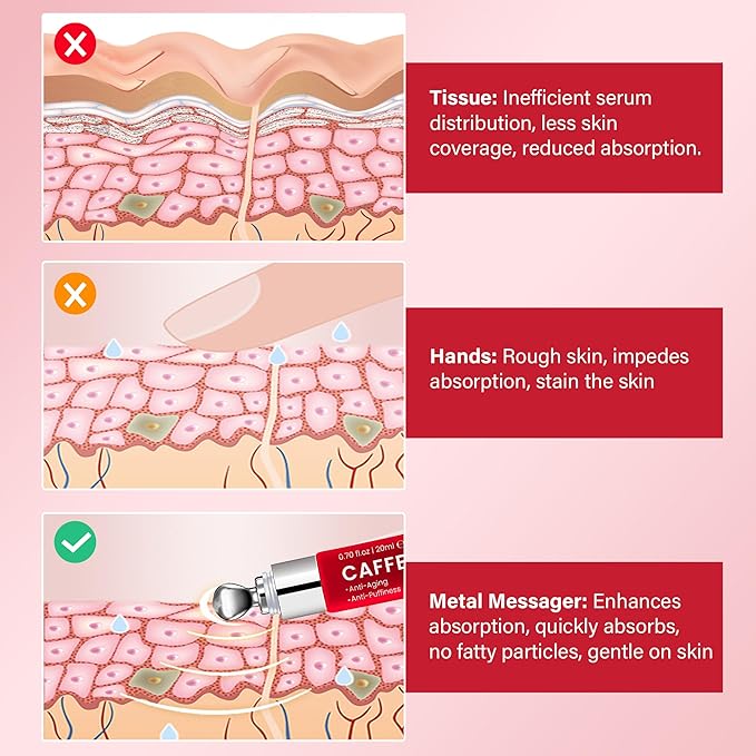 Caffeine Eye Cream Anti Aging: Eye Cream With Retinol, Sodium Hyaluronate, Vitamin E, For Dark Circles, Wrinkles, Puffiness & Fine Lines - Advanced Metal Applicator For Under Eye Bags And Puffy Eyes