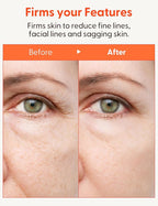 It'S SKIN Collagen Nutrition Eye Cream - Eye Bag Cream Eye Care w/Collagen | Korean Eye Cream for Dark Circles and Puffiness | Beauty & Personal Care Under Eye Cream for Puffiness and Bags 0.88 oz