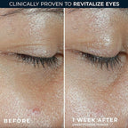 RoC Multi Correxion Revive + Glow Eye Balm with Vitamin C (0.14 oz) + Retinol Eye Cream Packette