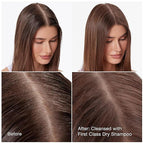 IGK FIRST CLASS Charcoal Detox Dry Shampoo | Volume + Soothes Scalp + Balance Oil | Vegan + Cruelty Free | 6.3 oz (Pack of 2)