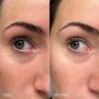 Topicals faded brightening under eye