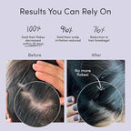 Jupiter Oil Control & Exfoliation Set, Anti-Dandruff Shampoo, Conditioner, Restoring Serum, Scalp Brush, & Purifying Mask, for Women & Men, Dermatologist-Formulated for Flaky, Itchy, Oily, & Dry Scalp