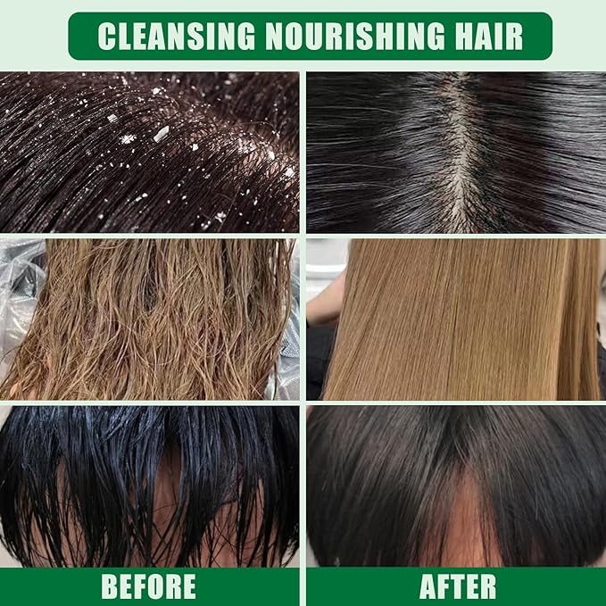 Solid Shampoo Conditioner Bar 2-In-1, Citrus Bar Shampoo for Dry, Itchy, and Oily Scalp, pH Balanced, Vegan Bars for Hair Strengthening Cleansing Moisturize, Cruelty-Free, 3 oz (Pack of 2)