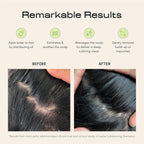 Jupiter Scalp Exfoliator - Scalp Massager Tool for Wet & Dry Hair - Ergonomic Detangler Brush - Dandruff Comb & Scrub to Remove Dandruff & Buildup and Support Circulation - Black