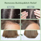 Scalp Scrub, Rosemary & Mint Oil & Biotin Scalp Exfoliator Scrub Shampoo with Silicone Cleansing Massager, Hair Treatment for Itchy Scalp, Dandruff & Buildup Removal & Thick and Strong Hair Growth