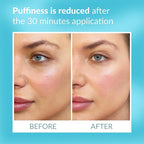 Talika eye therapy patch -