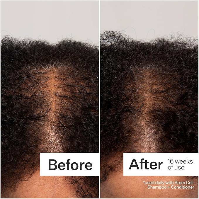 Act+Acre Cold Processed 3% Stem Cell Peptide Treatment | Boosts Hair Density | Grape Stem Cells, Peptides + Caffeine | Vegan, Fragrance-Free | 3 Fl Oz