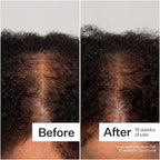 Act+Acre Cold Processed 3% Stem Cell Peptide Treatment | Boosts Hair Density | Grape Stem Cells, Peptides + Caffeine | Vegan, Fragrance-Free | 3 Fl Oz