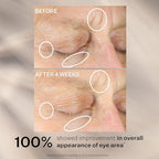 StriVectin Anti-Wrinkle Intensive Eye Cream Concentrate for Wrinkles PLUS, Targets Crow's Feet, Firmness, Puffiness and Dark Circles, 1 Fl oz