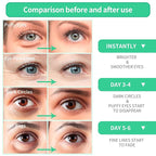 Breylee aloe vera eye masks??60