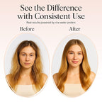 Kitsch Rice Water Shampoo Bar – Dry Hair Shampoo & Soap Bar for Hair Care & Hair Growth – Women and Mens Shampoo – Strengthens Damaged Hair – Vegan, Paraben, Silicone & Sulfate-Free – 3.2 oz