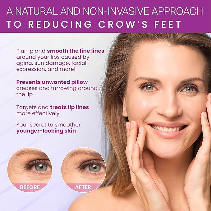 Furlesse Crows Wrinkle Patches, Overnight Eye Patches for Wrinkles and Crow’s Feet Lines, Non-invasive Anti-Wrinkle Patches, Anti-aging Skincare, 60 Patches, 30-Day Use