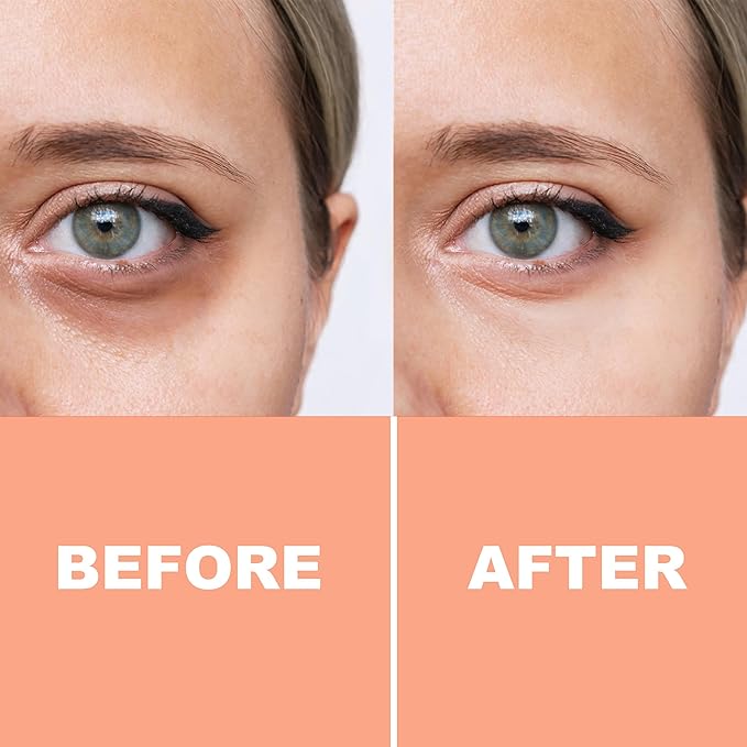 PURE FIJI Eye Cream Vitamin C Brightening Eye Cream, Under Eye Cream for Wrinkles and Bags, Under Eye Cream For Dark Circles, Smoothing & Anti-Aging Skincare (0.5oz/15ml)