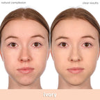 Almay Clear Complexion Acne Foundation Makeup with Salicylic Acid - Lightweight, Medium Coverage, Hypoallergenic, Fragrance-Free, for Sensitive Skin, 600 Sun Beige, 1 fl oz.
