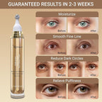 Under Eye Cream with Caffeine, Hyaluronic Acid, and Vitamins E, C, K - Advanced Dark Circle and Puffiness Treatment, Reduces Fine Lines