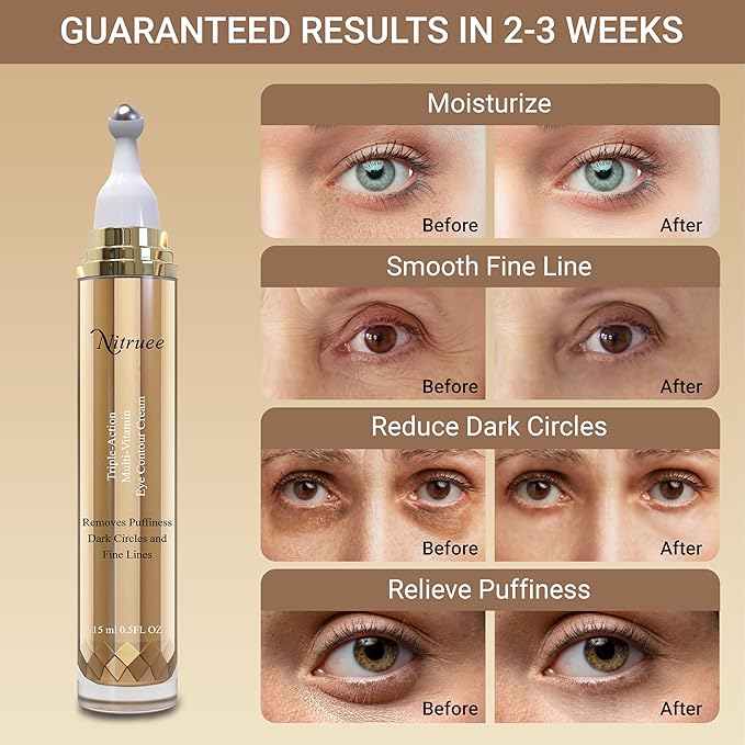 Under Eye Cream with Caffeine, Hyaluronic Acid, and Vitamins E, C, K - Advanced Dark Circle and Puffiness Treatment, Reduces Fine Lines