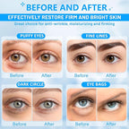 Under Eye Patches for Puffy Eyes: 30 Pairs Retinol Collagen Eye Gels Pads - Reduce Wrinkles, Puffy Eyes, Eye Bags - Skin Treatment Mask with Retinol Collagen - Anti Aging & Face Moisturizer