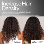 Act+Acre Cold Processed 3% Stem Cell Peptide Treatment | Boosts Hair Density | Grape Stem Cells, Peptides + Caffeine | Vegan, Fragrance-Free | 3 Fl Oz