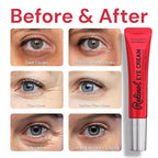 Anti-Aging Eye Cream for Wrinkles: Lifting and Tightening Under Eye Cream with Retinol & Collagen - Fine Lines Smoothing Treatment, Reduces Dark Circles, Eye Bags & Puffiness In 2 Weeks | 1.53 fl. oz