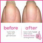 Essie Nail Strengthening Set, Hard To Resist Nail Strengthener, Glow & Shine, Neutralize & Brighten, 0.46 Fl Oz Each