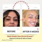 Dark under eye circle eraser??vitamin