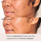 ALPYN Clarifying Facial Oil with Retinol & Pink Algae | Clear Congestion, Smooth Fine Lines, Improve Texture & Glow | 1 Fl Oz / 30 ml