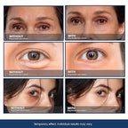 Bag Buster Eye Cream | Instant Reduction | Rapid Eye and Face Lift | Anti-Aging | instantly Reduces, Wrinkles, Dark Circles, Fine Lines, Under Eye Bags | Powdery Residue Or Flakes Free Formula | 10ml