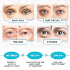 Under eye patches for puffy