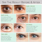 Under eye patches for dark