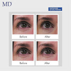 Md ultimate eye cream ??under