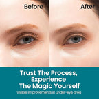 Under Eye Patches for Dark Circles | Korean Under Eye Patches & Puffy Eye Patches | Moisturizing Dark Circles Under Eye Treatment Skincare Snail Mucin Eye Patches & Dark Eyes Circle Treatment