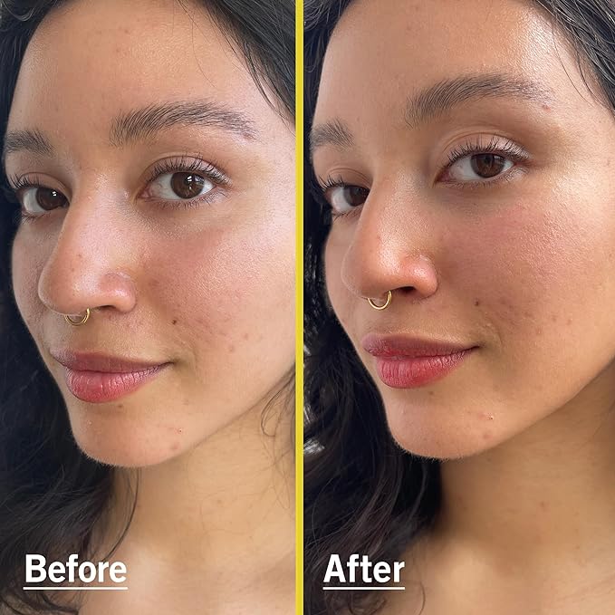 First Aid Beauty Weightless Liquid Mineral Sunscreen with Zinc Oxide SPF 30 – Luxuriously Light for Everyday Use – 1.5 oz