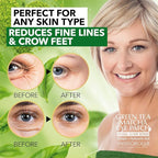 SWISSÖKOLAB Under Eye Patches For Puffy Eyes 24k Gold Eye Mask Dark Circles And Puffiness Collagen Eye Gel Pads Moisturizing & Reducing Wrinkles Anti-Aging Hyaluronic Acid (Green Tea)