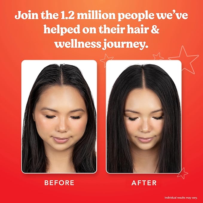 HAIRtamin Vitamin Infused Dry Shampoo for Women | Hair Texture Spray that Cleanses & Refreshes | Hair Complex for Healthy Thicker-Looking Hair | Procapil 3% & Vitamins for Scalp Health | Talc Free