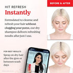 HAIRtamin Vitamin Infused Dry Shampoo for Women | Hair Texture Spray that Cleanses & Refreshes | Hair Complex for Healthy Thicker-Looking Hair | Procapil 3% & Vitamins for Scalp Health | Talc Free