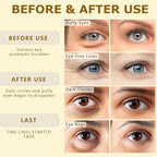 COSMETIC |24k Gold Vitality-Fill Hydra-Gel Eye Patches | Anti-Aging Under-Eye Patches, Help Boosting Lift & Firm the Look of the Eye Area