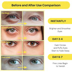 Under eye patches - 60