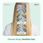 TS GD Shampoo for Teens | Korean Anti-Dandruff Shampoo for Oily & Itchy Scalp | Fruity Allergy-Free Scent | Sulfate-Free Gentle Hair Care (14.1 Oz)