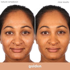 Almay Clear Complexion Acne Foundation Makeup with Salicylic Acid - Lightweight, Medium Coverage, Hypoallergenic, Fragrance-Free, for Sensitive Skin, 705 Toast, 1 fl oz.